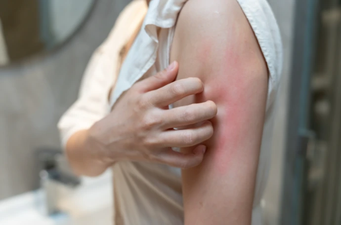 itchy skin because of hard water