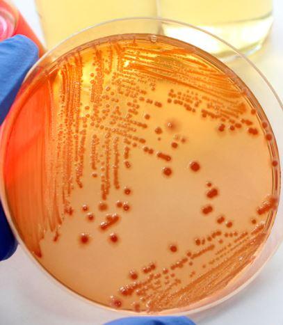 Unseen contaminants